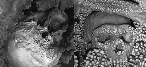 تحقق من رجل الكهف مندمجا في الصخر. بعد استخراج العظام البارزة من الحجر الجيري ، يعتقد الباحثون أن إنسان نياندرتال سقط في حفرة منذ حوالي 150,000 ألف عام. تدمجت العظام تدريجياً في الهوابط التي خلفتها المياه المتساقطة أسفل جدران الكهف.