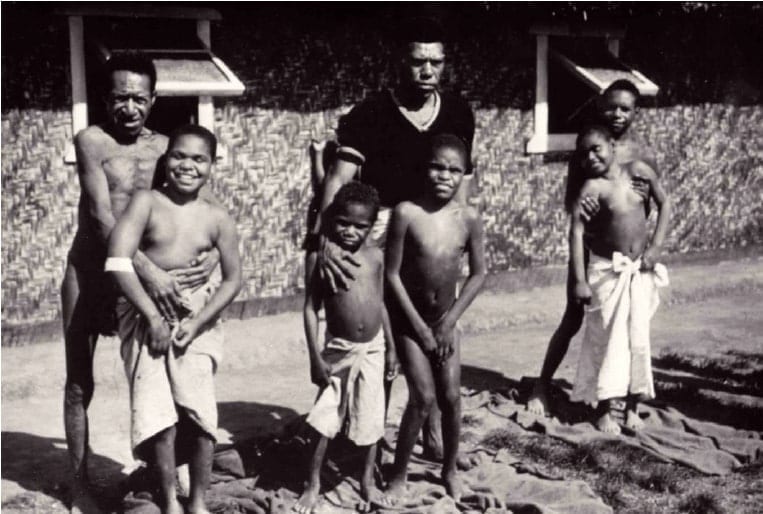 Cos'è la malattia di Kuru?