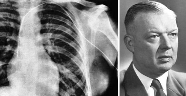 من أجرى أول قسطرة قلبية؟