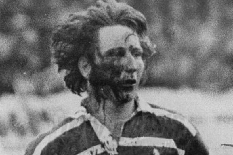 How Bad was JPR Williams' Injury in the 1978 Rugby Match Against New Zealand?